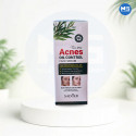 Acne Oil Control Serum
