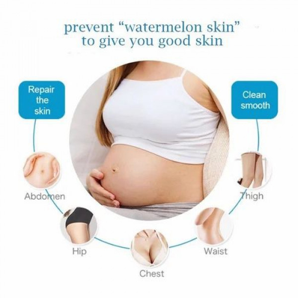 GuanJing Anti Stretch Mark Cream Shape Perfection