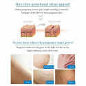 GuanJing Anti Stretch Mark Cream Shape Perfection