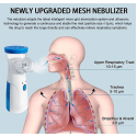 Portable Nebulizer- মেশ নেবুলাইজার