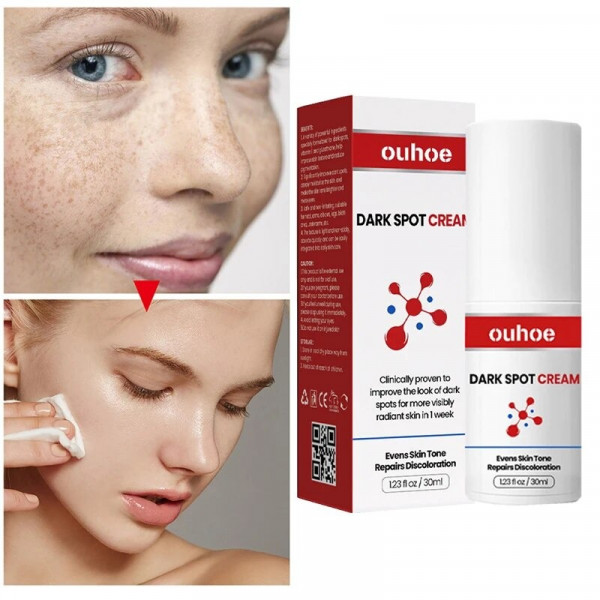 Dark Spot Cream